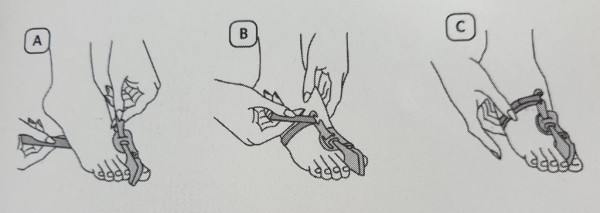 Stock Fachmann Hallux valgus Nachtschiene Verkauf